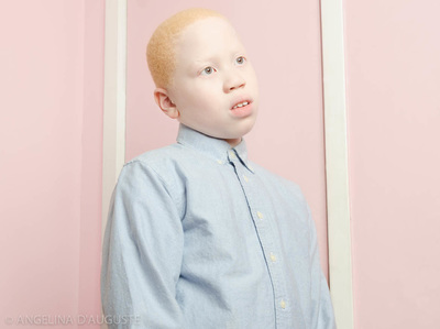 Angelina D Auguste Photography Albinos